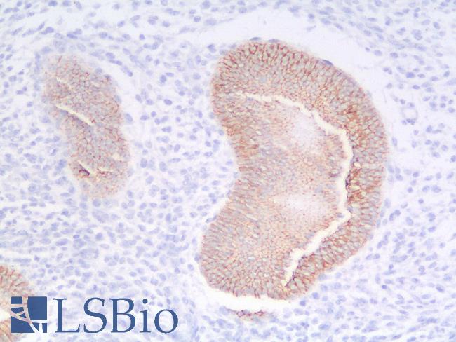 CDH1 / E Cadherin Antibody - Human Uterus: Formalin-Fixed, Paraffin-Embedded (FFPE)