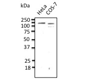 CDH1 / E Cadherin Antibody - Endogenous CDH1 detected with Anti-CDH1 Ab at 1:500 dilution. Lysate at 100ug per lane.