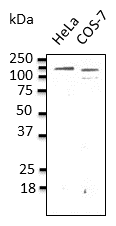 CDH1 / E Cadherin Antibody - Endogenous CDH1 detected with anti-CDH1 at 1:500 dilution; lysate at 100 ug per lane and rabbit polyclonal to goat IgG (HRP) at 1:10,000 dilution;
