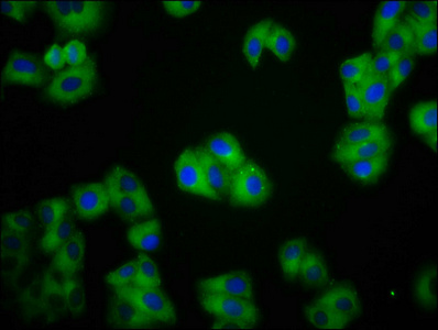 CDH1 / E Cadherin Antibody - Immunofluorescence staining of HepG2 cells diluted at 1:100, counter-stained with DAPI. The cells were fixed in 4% formaldehyde, permeabilized using 0.2% Triton X-100 and blocked in 10% normal Goat Serum. The cells were then incubated with the antibody overnight at 4°C.The Secondary antibody was Alexa Fluor 488-congugated AffiniPure Goat Anti-Rabbit IgG (H+L).