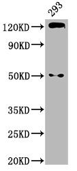 CDH1 / E Cadherin Antibody - Western Blot Positive WB detected in: 293 whole cell lysate All Lanes: CDH1 antibody at 2.9µg/ml Secondary Goat polyclonal to rabbit IgG at 1/50000 dilution Predicted band size: 98, 91 KDa Observed band size: 125 KDa