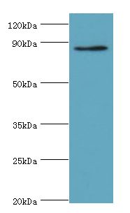 CDH11 / Cadherin 11 Antibody - Western blot. All lanes: CDH11 antibody at 6 ug/ml+Jurkat whole cell lysate. Secondary antibody: Goat polyclonal to rabbit at 1:10000 dilution. Predicted band size: 88 kDa. Observed band size: 88 kDa.