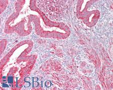 CDH11 / Cadherin 11 Antibody - Human Uterus: Formalin-Fixed, Paraffin-Embedded (FFPE), at a concentration of 10 µg/ml
