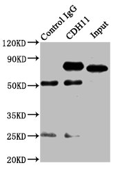CDH11 / Cadherin 11 Antibody - Immunoprecipitating CDH11 in SH-SY5Y whole cell lysate Lane 1: Rabbit control IgG instead of CDH11 Antibody in SH-SY5Y whole cell lysate.For western blotting, a HRP-conjugated Protein G antibody was used as the secondary antibody (1/5000) Lane 2: CDH11 Antibody (8µg) + SH-SY5Y whole cell lysate (500µg) Lane 3: SH-SY5Y whole cell lysate (20µg)
