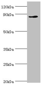 CDH11 / Cadherin 11 Antibody - Western blot All lanes: CDH11 antibody at 6µg/ml + Jurkat whole cell lysate Secondary Goat polyclonal to rabbit IgG at 1/10000 dilution Predicted band size: 88, 77 kDa Observed band size: 88 kDa