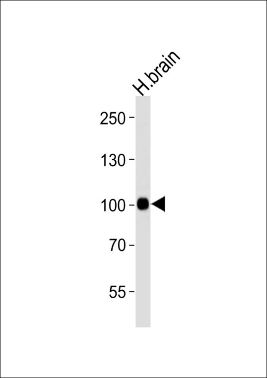 CDH13 / Cadherin 13 Antibody - Western blot of lysate from human brain tissue lysate, using CDH13 Antibody. Antibody was diluted at 1:1000 at each lane. A goat anti-rabbit IgG H&L (HRP) at 1:5000 dilution was used as the secondary antibody. Lysate at 35ug per lane.