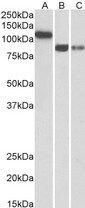 CDH13 / Cadherin 13 Antibody - Goat Anti-CDH13 / H-cadherin Antibody (0.3?/ml) staining of Human Heart (A), Amygdala (B) and Hippocampus (C) lysates (35? protein in RIPA buffer). Primary incubation was 1 hour. Detected by chemiluminescence.