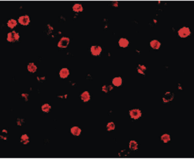 CDH13 / Cadherin 13 Antibody - Immunofluorescence of T-cadherin in K562 cells with T-cadherin antibody at 20 ug/ml.