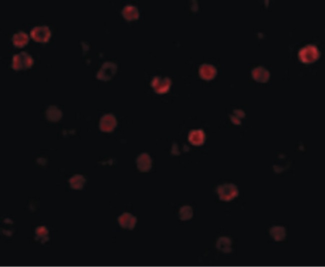 CDH13 / Cadherin 13 Antibody - Immunofluorescence of T-cadherin in 3T3 cells with T-cadherin antibody at 2 ug/ml.