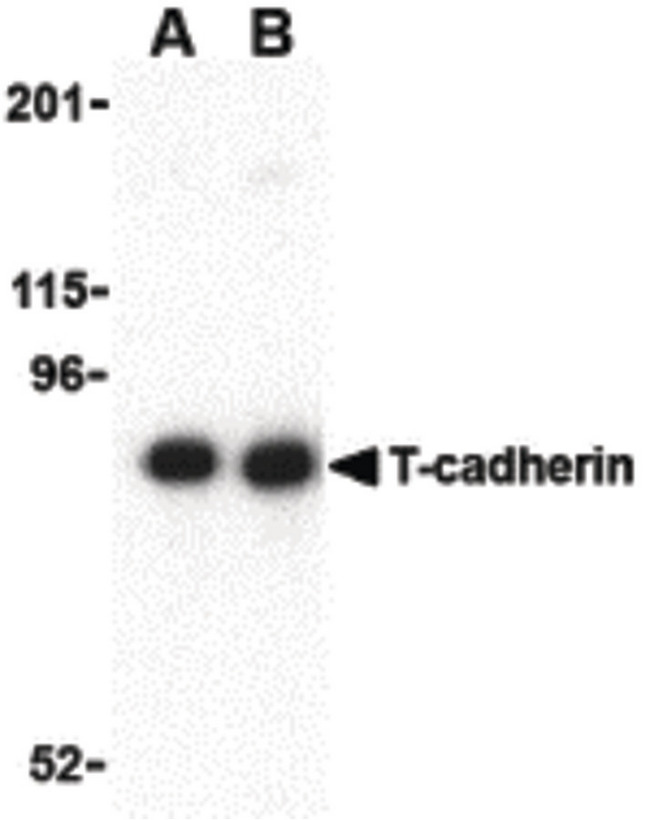 CDH13 / Cadherin 13 Antibody - Western blot of T-cadherin in 3T3 lysate with T-cadherin antibody at (A) 0.5 and (B) 1 ug/ml.