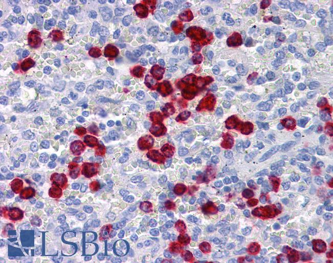 CDH18 / Ey-Cadherin Antibody - Anti-CDH18 antibody IHC of human spleen. Immunohistochemistry of formalin-fixed, paraffin-embedded tissue after heat-induced antigen retrieval. Antibody concentration 5 ug/ml.