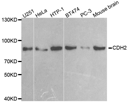 CDH2 / N Cadherin Antibody - Western blot analysis of extracts of various cell lines, using CDH2 antibody.