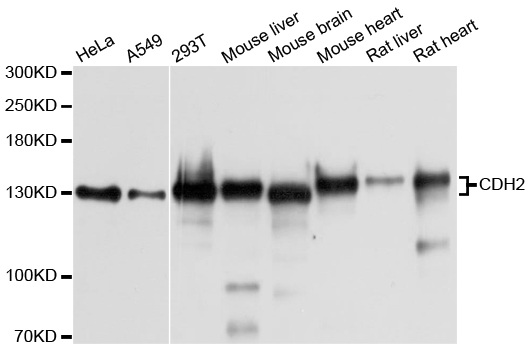 CDH2 / N Cadherin Antibody - Western blot analysis of extracts of various cell lines.
