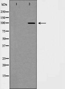 CDH2 / N Cadherin Antibody - Western blot analysis of CDH2 expression in Jurkat cells. The lane on the left is treated with the antigen-specific peptide.