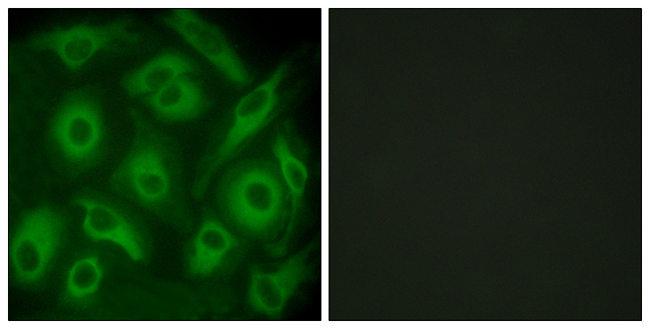 CDH23 / Cadherin 23 Antibody - Immunofluorescence analysis of HeLa cells, using CDH23 Antibody. The picture on the right is blocked with the synthesized peptide.