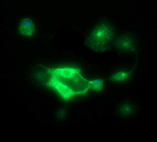 CDH3 / P-Cadherin Antibody - Anti-CDH3 mouse monoclonal antibody immunofluorescent staining of COS7 cells transiently transfected by pCMV6-ENTRY CDH3.