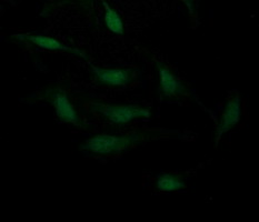 CDH3 / P-Cadherin Antibody - Immunofluorescent staining of HeLa cells using anti-CDH3 mouse monoclonal antibody.