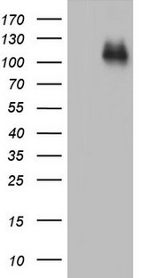 CDH4 / R Cadherin Antibody - HEK293T cells were transfected with the pCMV6-ENTRY control (Left lane) or pCMV6-ENTRY CDH4 (Right lane) cDNA for 48 hrs and lysed. Equivalent amounts of cell lysates (5 ug per lane) were separated by SDS-PAGE and immunoblotted with anti-CDH4.