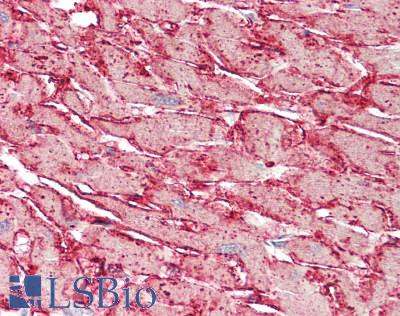 CDH4 / R Cadherin Antibody - Human Heart: Formalin-Fixed, Paraffin-Embedded (FFPE), at a concentration of 10 ug/ml. 