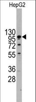 CDH4 / R Cadherin Antibody - Western blot of anti-CDH4 Antibody (RB13654) in HepG2 cell line lysates (35 ug/lane). CDH4(arrow) was detected using the purified antibody.
