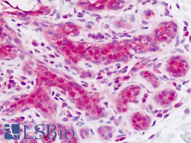 CDH4 / R Cadherin Antibody - Human Breast: Formalin-Fixed, Paraffin-Embedded (FFPE)