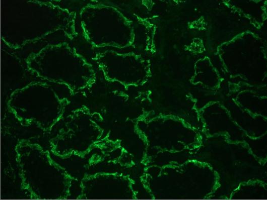 CDH6 / K Cadherin Antibody - Immunofluorescent staining on frozen section of human kidney: positive reactivity in renal tubules (epithelium)