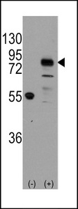 CDH9 / Cadherin 9 Antibody - Western blot of CDH9 (arrow) using rabbit polyclonal CDH9 Antibody. 293 cell lysates (2 ug/lane) either nontransfected (Lane 1) or transiently transfected with the CDH9 gene (Lane 2) (Origene Technologies).