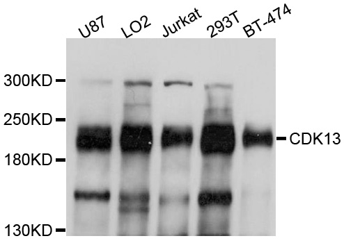 CDK13 / CDC2L5 Antibody - Western blot analysis of extracts of various cell lines, using CDK13 antibody at 1:1000 dilution. The secondary antibody used was an HRP Goat Anti-Rabbit IgG (H+L) at 1:10000 dilution. Lysates were loaded 25ug per lane and 3% nonfat dry milk in TBST was used for blocking. An ECL Kit was used for detection and the exposure time was 1s.