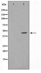 CDK15 / ALS2CR7 Antibody - Western blot of Jurkat cell lysate using AL2S7 Antibody
