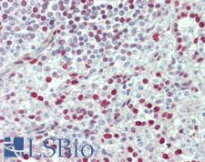 CDK15 / ALS2CR7 Antibody - Human Spleen: Formalin-Fixed, Paraffin-Embedded (FFPE)