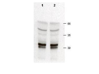 CDK2 Antibody - Anti-cdk2 Antibody - Western Blot. Rabbit anti-cdk2 was used at a 1:200 dilution to detect cdk-2 in asynchronous HeLa cell lysates (run in duplicate). Approximately 50 ug of lysate was separated on a 15% SDS-PAGE gel. Cdk-2 is indicated by an arrowhead as a 32-33 kD band. Note that multiple isoforms as well as phosphorylated forms of cdk-2 may be detected by this antibody. Primary antibody was reacted at room temperature for 1 h. After subsequent washing, a 1:5000 dilution of HRP conjugated Gt-a-Rabbit IgG (LS-C60865) preceded color development.