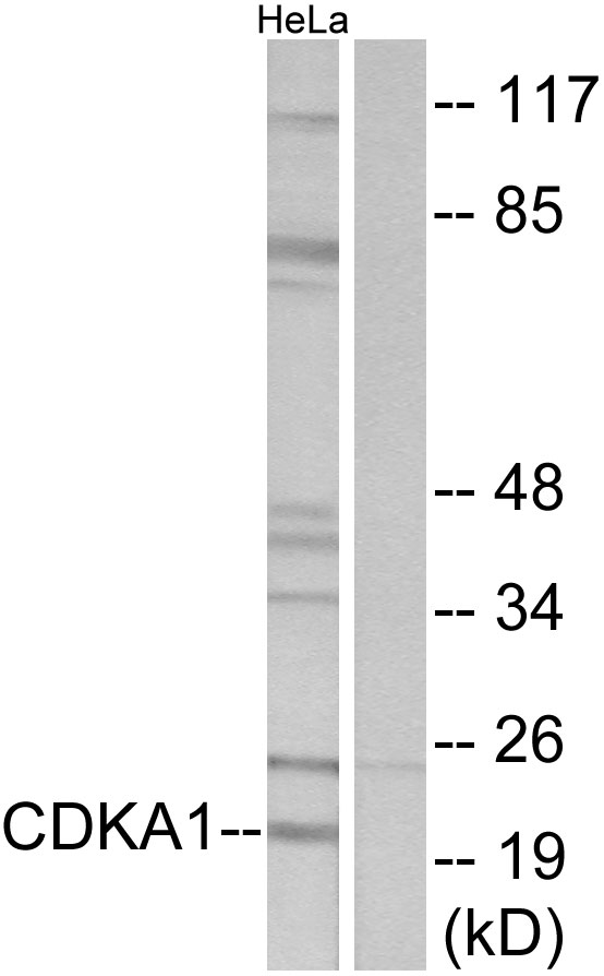 CDK2AP1 / DOC1 Antibody - Western blot analysis of lysates from HeLa cells, using CDKPA1 Antibody. The lane on the right is blocked with the synthesized peptide.