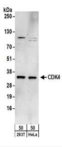 CDK4 Antibody - Detection of Human CDK4 by Western Blot. Samples: Whole cell lysate (50 ug) from 293T and HeLa cells. Antibodies: Affinity purified rabbit anti-CDK4 antibody used for WB at 0.1 ug/ml. Detection: Chemiluminescence with an exposure time of 3 minutes.