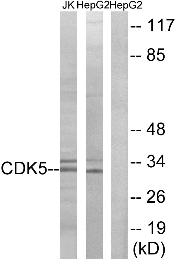 CDK5 Antibody - Western blot analysis of lysates from HepG2 and Jurkat cells, using CDK5 Antibody. The lane on the right is blocked with the synthesized peptide.