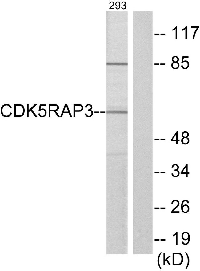 CDK5RAP3 Antibody - Western blot analysis of lysates from 293 cells, using CDK5RAP3 Antibody. The lane on the right is blocked with the synthesized peptide.