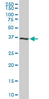 CDK6 Antibody - CDK6 monoclonal antibody (M01), clone 8H4. Western blot of CDK6 expression in PC-12.