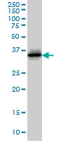 CDK6 Antibody - CDK6 monoclonal antibody (M01), clone 8H4 Western blot of CDK6 expression in Jurkat.