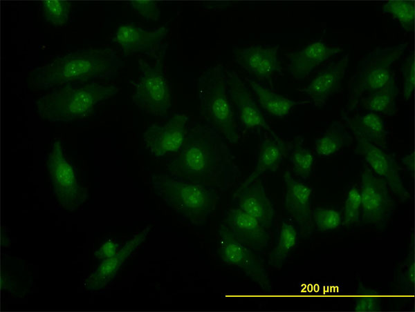 CDK6 Antibody - Immunofluorescence of monoclonal antibody to CDK6 on HeLa cell. [antibody concentration 10 ug/ml]