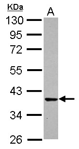 CDK6 Antibody - Sample (30 ug of whole cell lysate) A: IMR32 10% SDS PAGE CDK6 antibody diluted at 1:1000