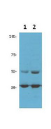 CDK9 Antibody - Anti-cdk9 (PITALRE) Antibody - Western blot. Anti-cdk9 antibody (1:1500 ) was used for Western blot of 1) PC3 and 2) DU145 prostate cancer cells (50 ug per lane). Bands at the expected MW of 55 and 42 Kda were detected. Personal communication Flavio Rizzolio, Temple University.