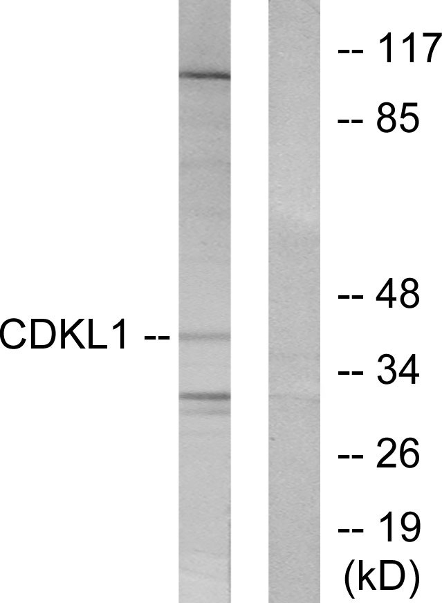 CDKL1 Antibody - Western blot analysis of lysates from COLO205 cells, using CDKL1 Antibody. The lane on the right is blocked with the synthesized peptide.
