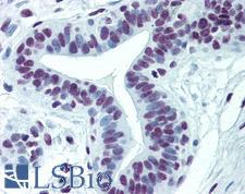 CDKL1 Antibody - Anti-CDKL1 antibody IHC of human breast. Immunohistochemistry of formalin-fixed, paraffin-embedded tissue after heat-induced antigen retrieval. Antibody concentration 5 ug/ml.