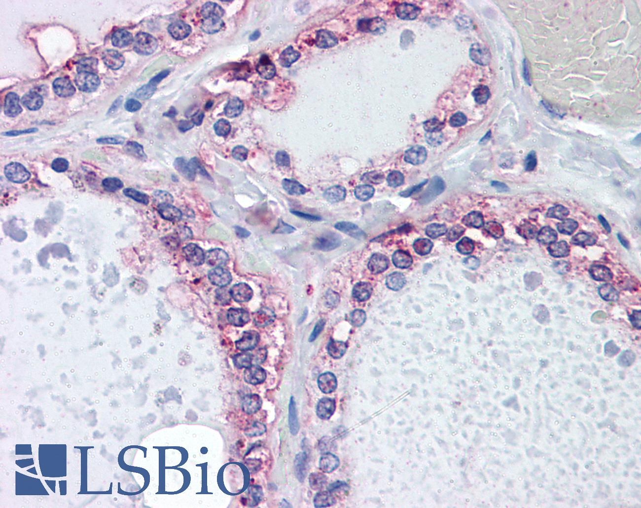 CDKL2 Antibody - Anti-CDKL2 antibody IHC of human thyroid. Immunohistochemistry of formalin-fixed, paraffin-embedded tissue after heat-induced antigen retrieval. Antibody concentration 5 ug/ml.