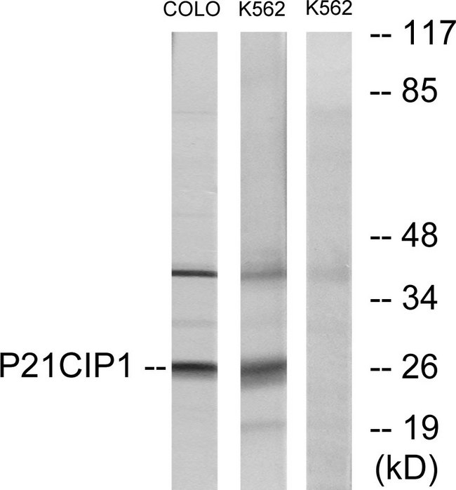 CDKN1A / WAF1 / p21 Antibody - Western blot analysis of lysates from COLO and K562 cells, treated with EGF, using p21 Cip1 Antibody. The lane on the right is blocked with the synthesized peptide.