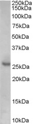 CDKN1B / p27 Kip1 Antibody - Antibody (0.1 ug/ml) staining of Human Prostate lysate (35 ug protein in RIPA buffer). Primary incubation was 1 hour. Detected by chemiluminescence.