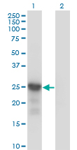 CDKN1B / p27 Kip1 Antibody - Western blot of CDKN1B expression in transfected 293T cell line by CDKN1B monoclonal antibody (M01), clone 4B4-E6.
