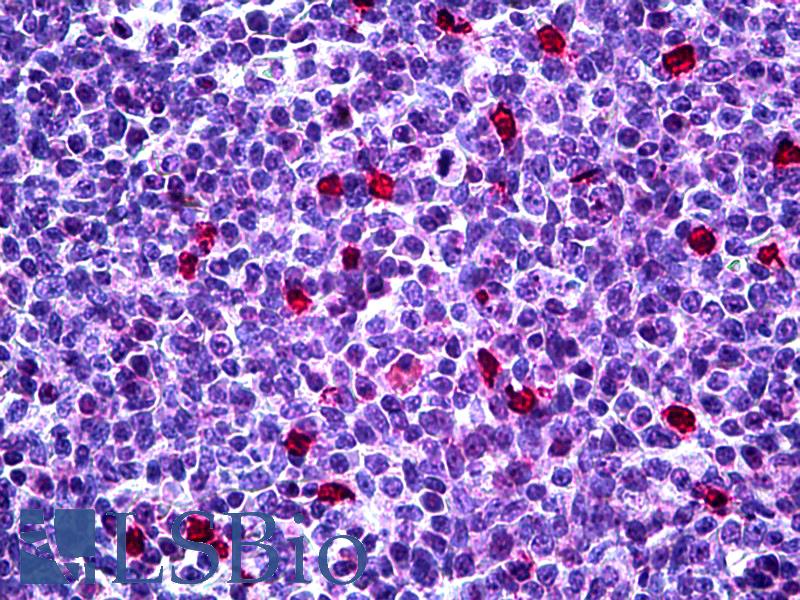 CDKN1B / p27 Kip1 Antibody - Anti-CDKN1B / p27 Kip1 antibody IHC of human tonsil. Immunohistochemistry of formalin-fixed, paraffin-embedded tissue after heat-induced antigen retrieval. Antibody concentration 5 ug/ml.