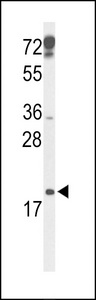 CDKN2D / p19 INK4d Antibody - Western blot of p19 Antibody in mouse testis tissue lysates (35 ug/lane). p19 (arrow) was detected using the purified antibody.