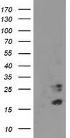 CDKN3 / KAP Antibody - HEK293T cells were transfected with the pCMV6-ENTRY control (Left lane) or pCMV6-ENTRY CDKN3 (Right lane) cDNA for 48 hrs and lysed. Equivalent amounts of cell lysates (5 ug per lane) were separated by SDS-PAGE and immunoblotted with anti-CDKN3.