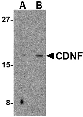 CDNF / ARMETL1 Antibody - Western blot of CDNF in mouse brain tissue lysate with CDNF antibody at (A) 2 and (B) 4 ug/ml.